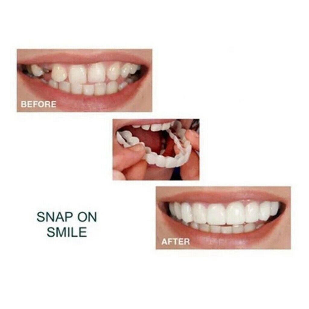 1Pcs Soft Silicone Top Upper Cosmetic Teeth Cover Veneers Instant Smile