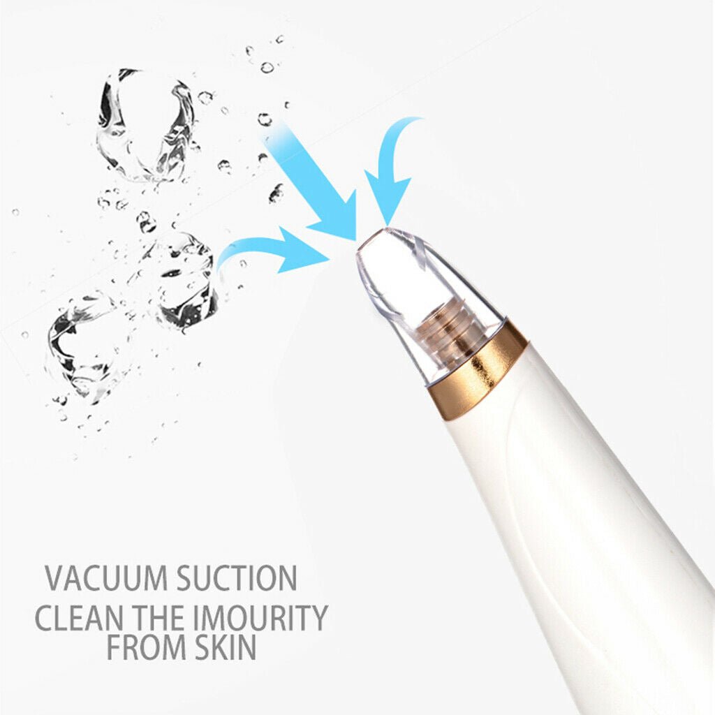 Blackhead Acne Comedo Blemish Remover Face Tightening Pore Cleansing Device