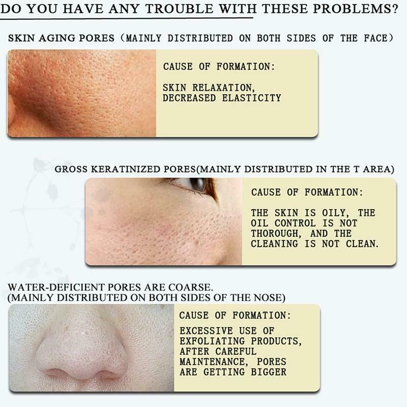 10ml Hyaluronic Acid Shrink Pores Essence Facial Moisturizing Nourishing Serum