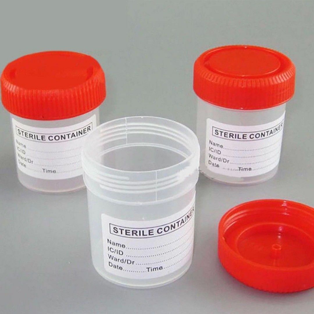 Urine Collection Container  Sample Specimen Bottle Cup 60 ML Plastic