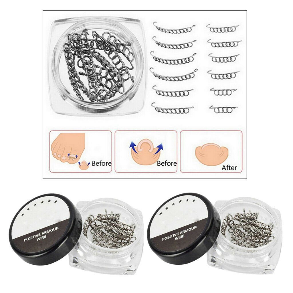 Ingrown Toenails Corrector Paronychia Patch Foot Pedicure Tool Nail Care