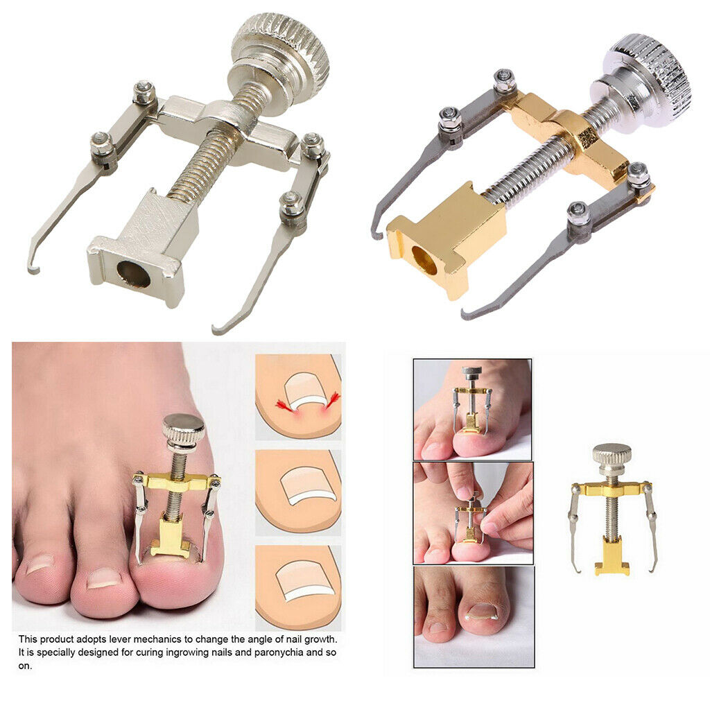 2 pcs. Professional tool for correcting ingrown toenails