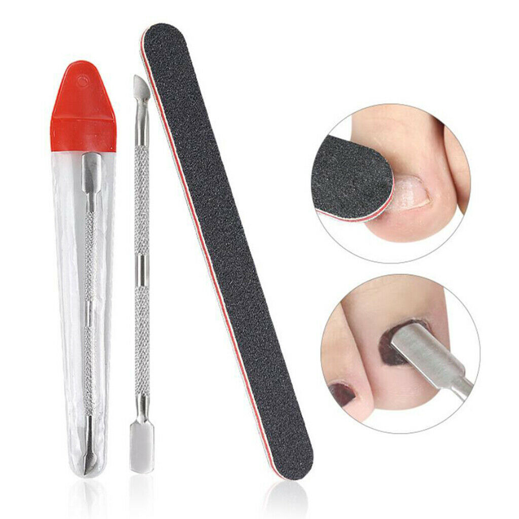 Ingrown Toenail Corrector Patch Brace Treatment