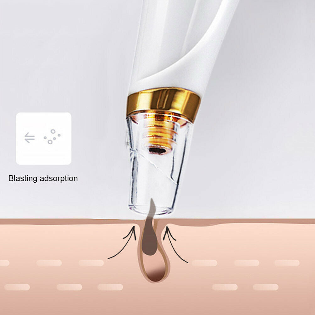 Blackhead Remover Vacuum Pimple Extractor Acne Removal Kit Face Cleaner Care