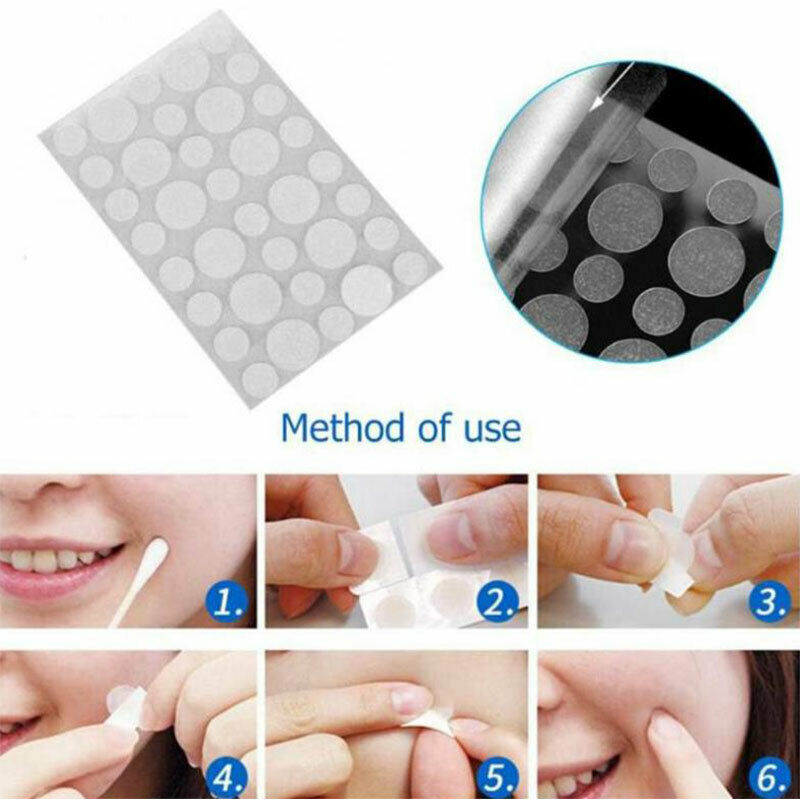 36PCS Fast Remover Pimple Patch Treatment Acne Patch Skin Tag Beauty Make.l8