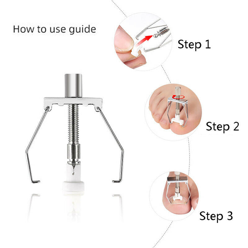 Ingrown Nail Recover Correction Pedicure Toenail Fixer Care Tool Nail CorrecFCA