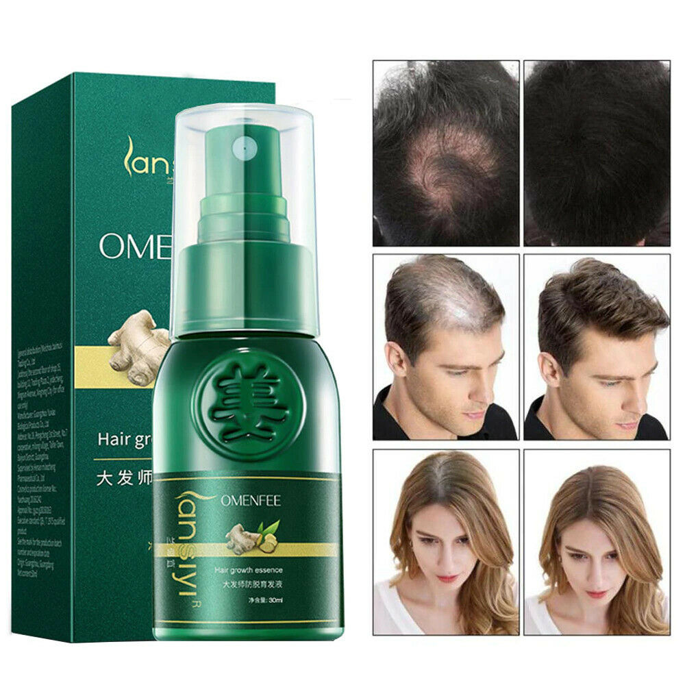 Ginger Hair Growth Essential Spray Anti Hair Loss Serum 7 Days Effective 30ml