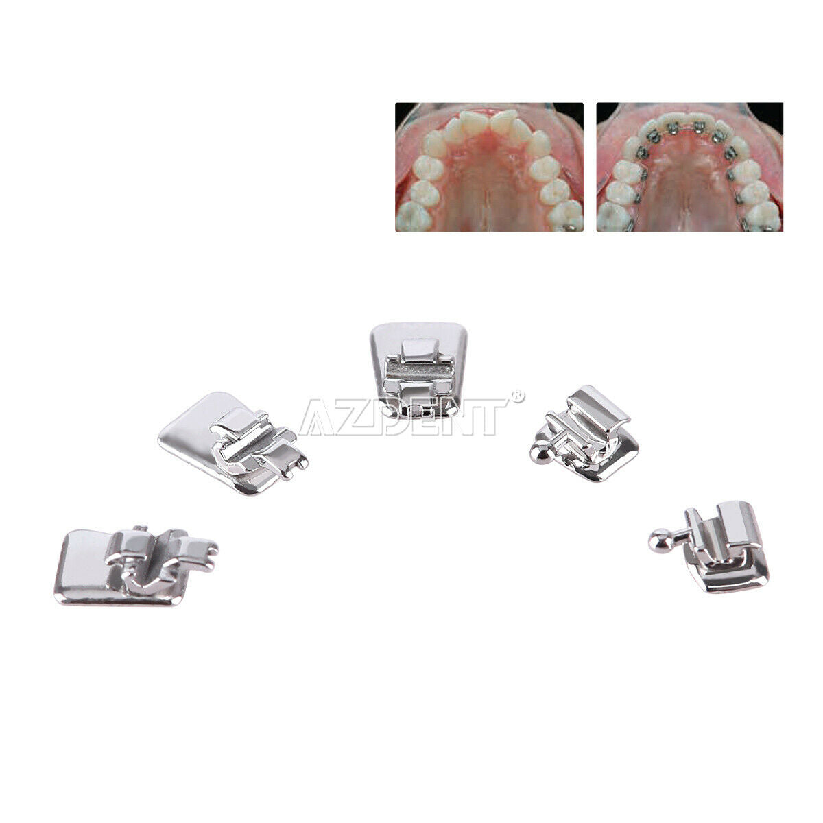 2 Case Dental Orthodontic Lingual Metal Bracket Braces Mini 0.018