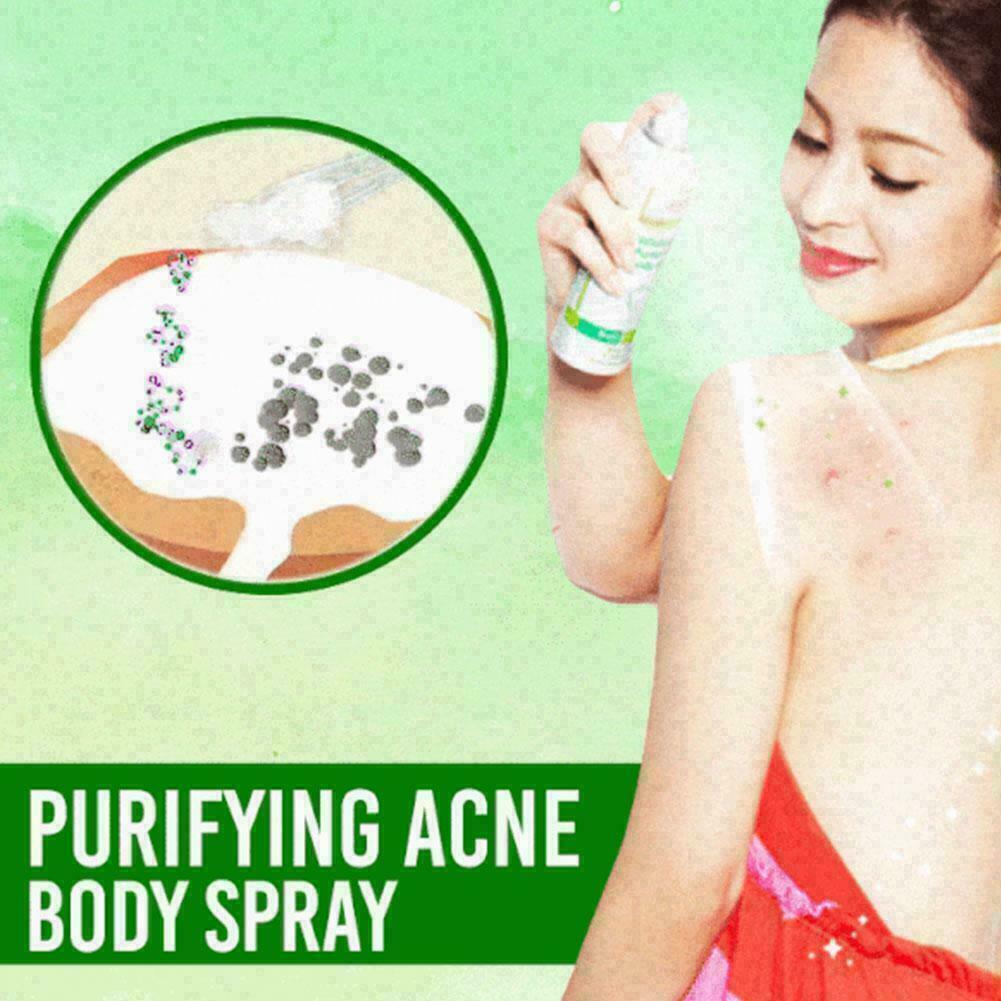 Purifying Acne Body Spray Salicylic acid acne spray 6T5R C6Q3 HOT NEW