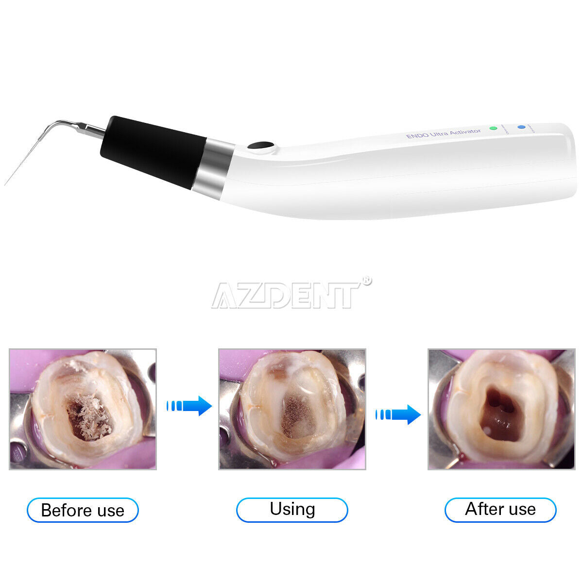 Dental Ultra Endo Activator Handpiece Irrigator + Apex Locator Kit