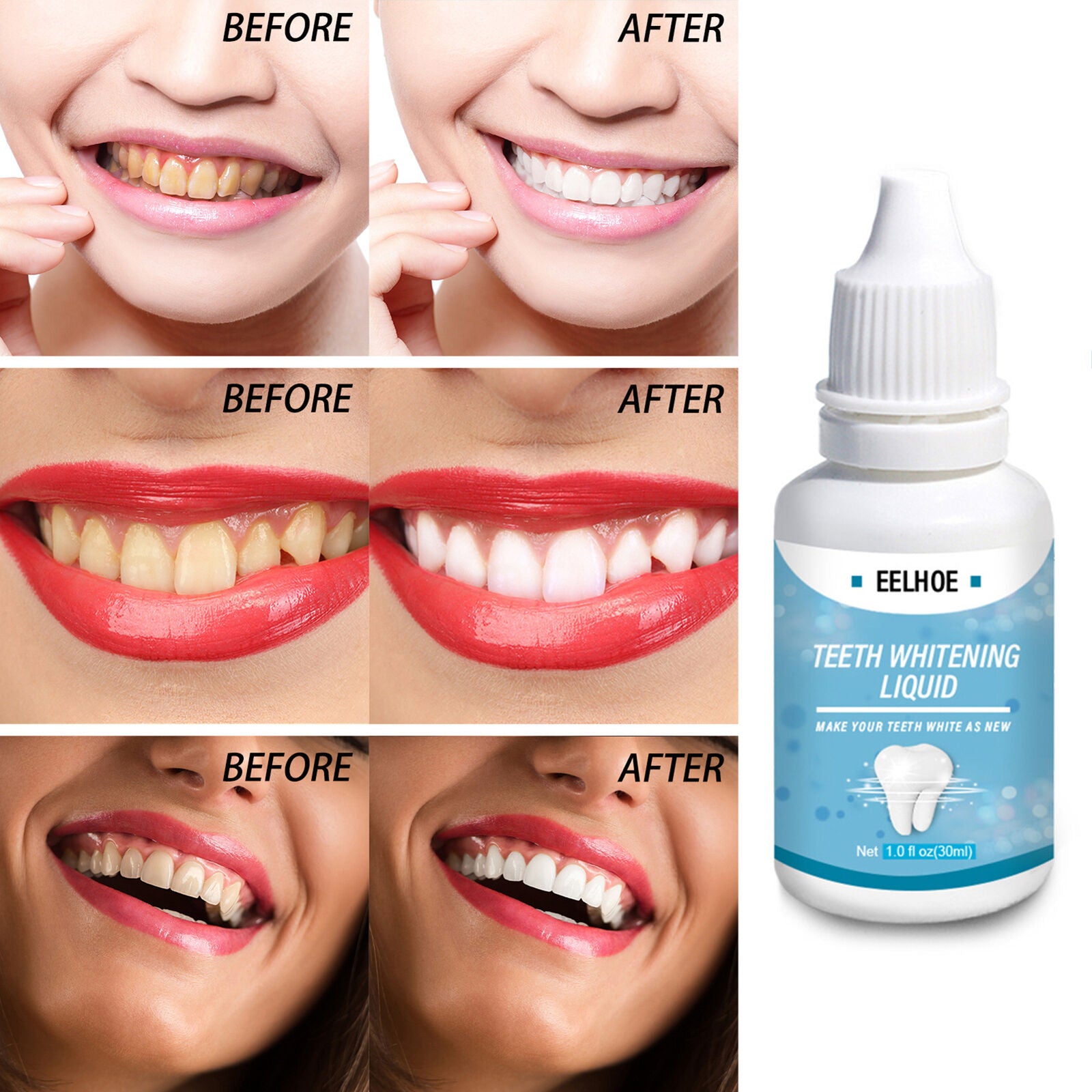 30ML Teeth Removing Water Convenient Lightweight Easy to Use Helpful for Home