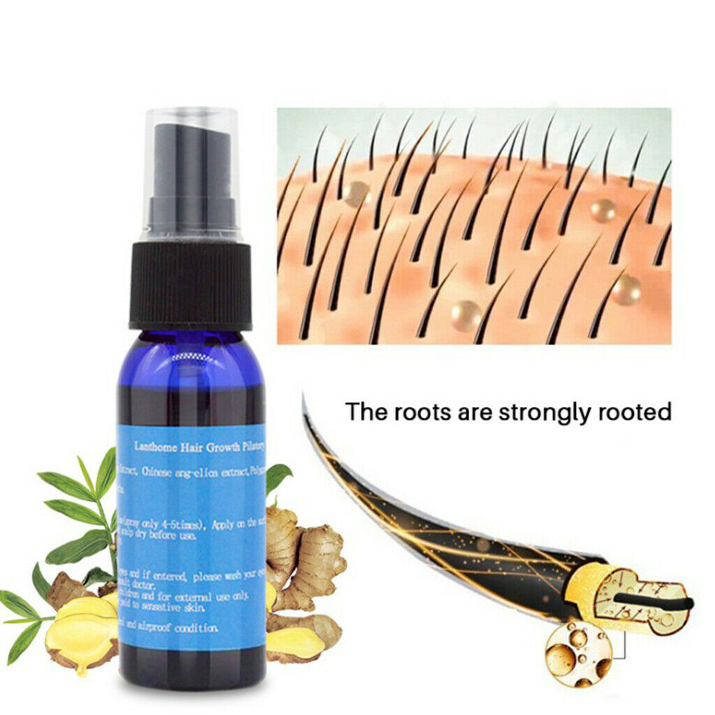 Natural Ginger Hair Growth Essence Anti Hair Loss Spray Beard Regrowth 30ml