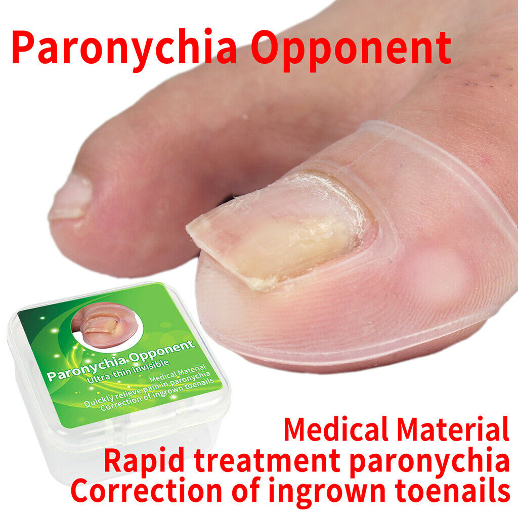 Silicone Ingrown Toe Nail Correction Sleeves Cover Paronychia Straightener