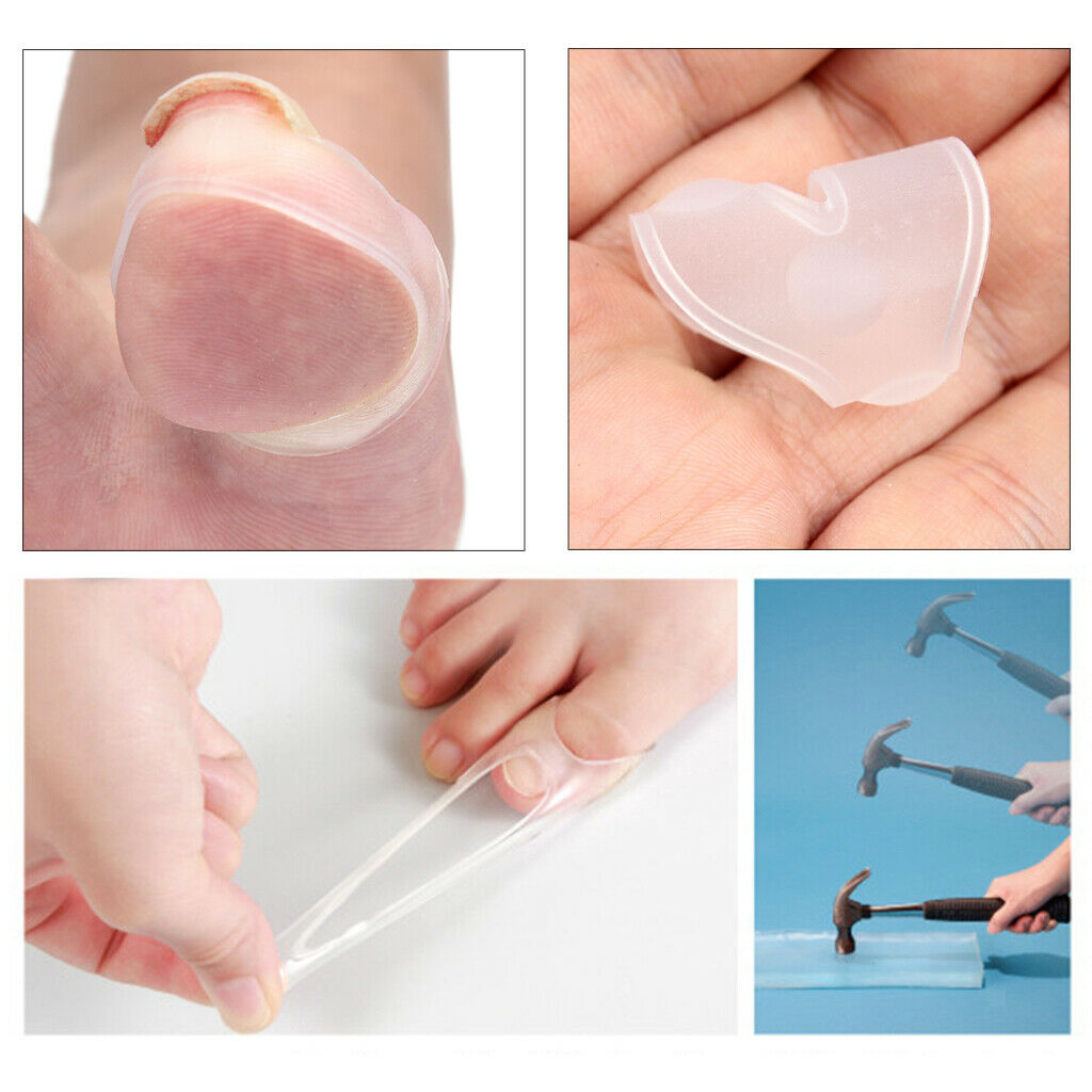Clear Toe Nail Repair Correction Sleeves Paronychia Treatment Straightener