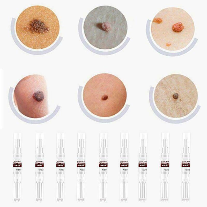 10ml Skin Tags Moles Remover Pen Facial Body Wart Dark Spot Treatment Liquid