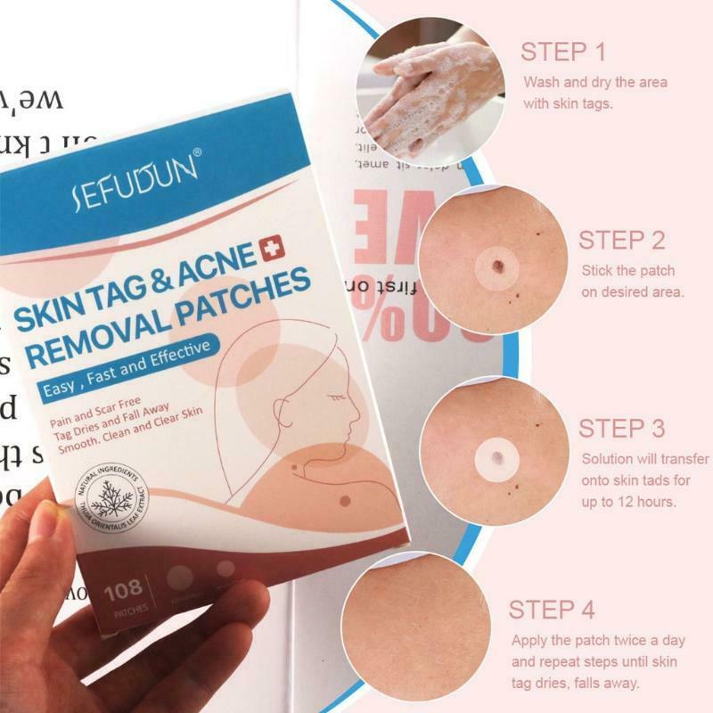 108 Patches Skin Tag Remover Patch Wart Removal Stickers Cover Conceals Tags