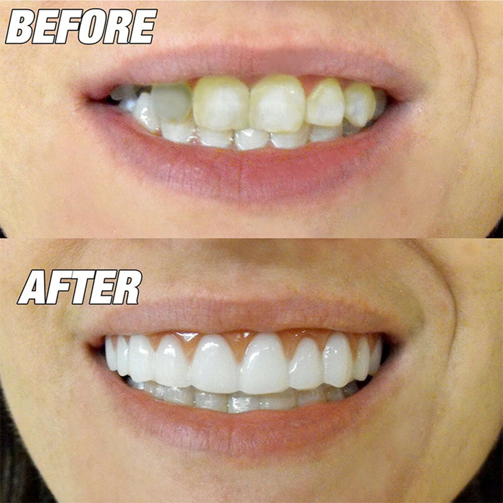 Smiling Braces Top False Teeth Veneers Tooth Covering Simulation