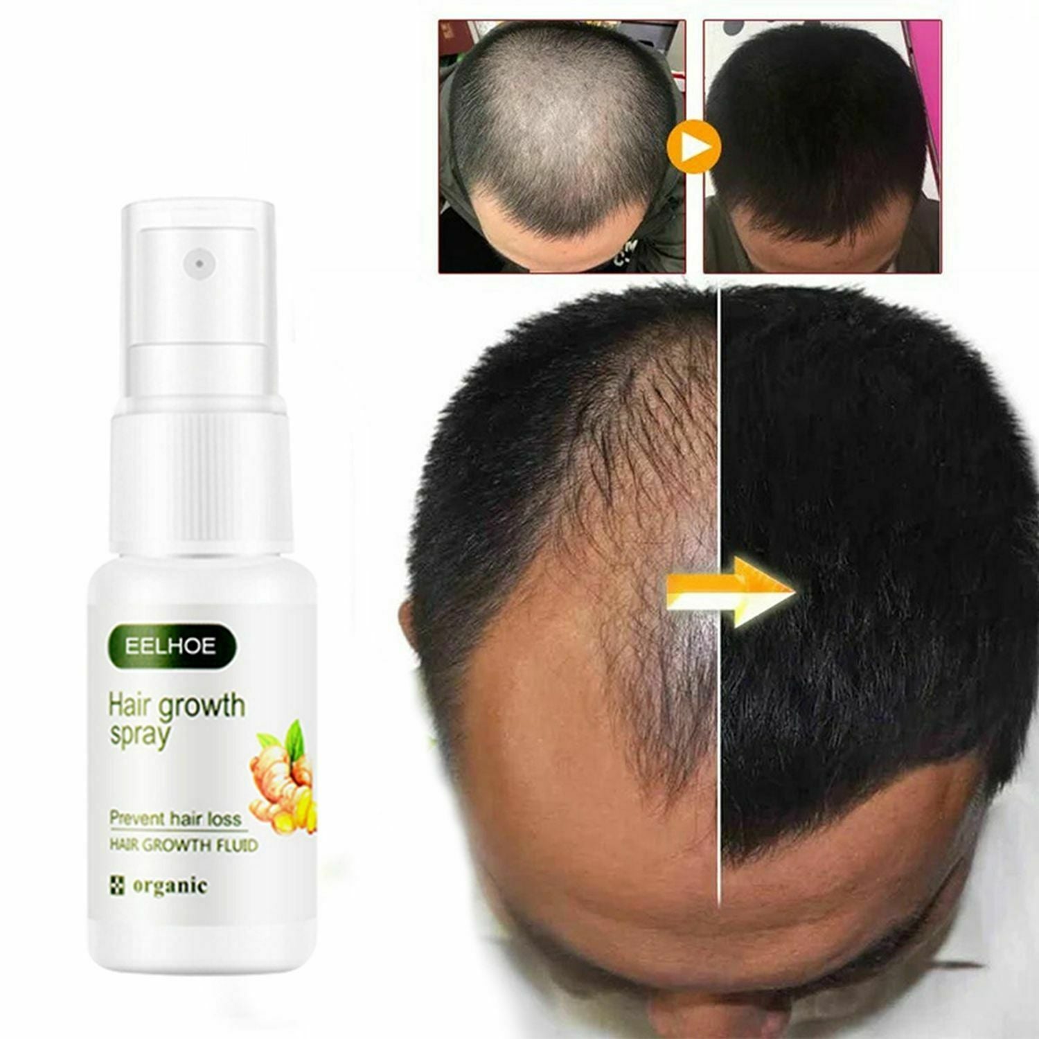 Anti Hair Loss Hair Care Pilatory Germinal Dense Serum Ginger Hair Growth Spray