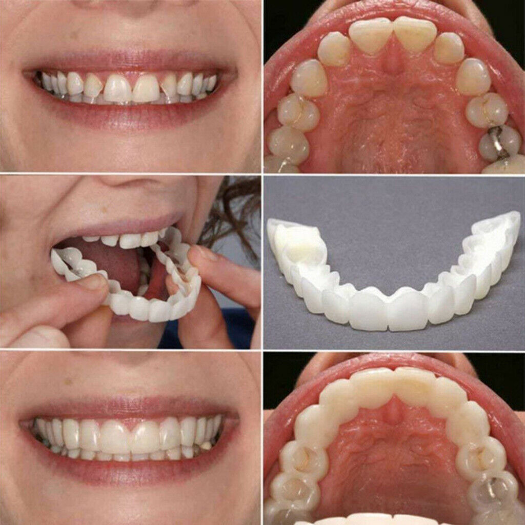 2Pcs Upper & Lower Cosmetic Teeth Cover False Teeth Veneers Instant Smile