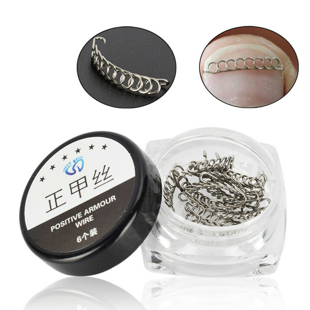 Nail Care Ingrown Toenail Correction Wire Fixer Toe Nail Corrector Pedicure