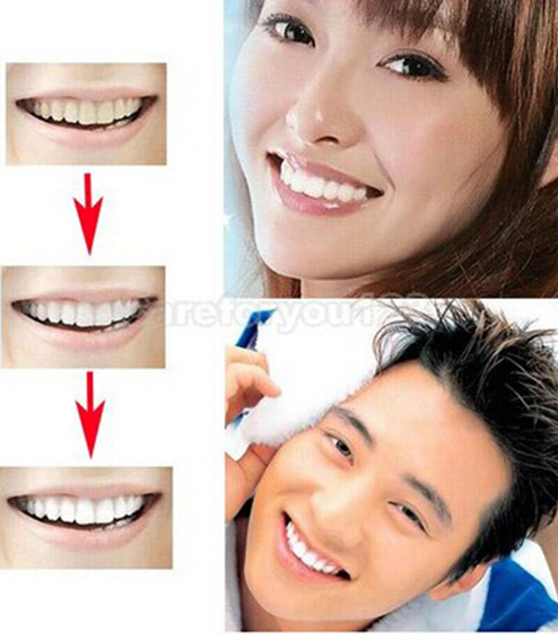 Eraser Teeth Whiten Cleaning Tooth Bleach Whiting Dental Peeling St wxH XC