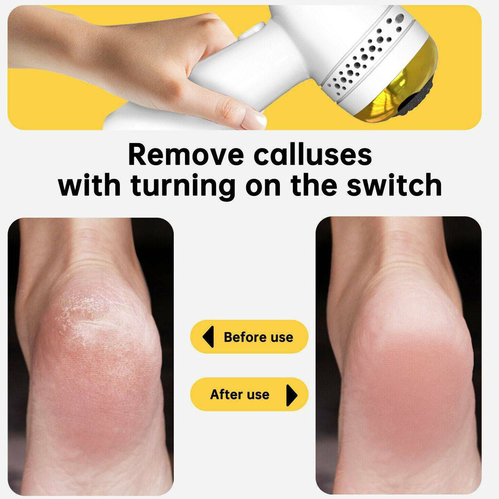Electric Vacuum Foot Grinder File Dead Skin Callus Remover Exfoliate Adsorption