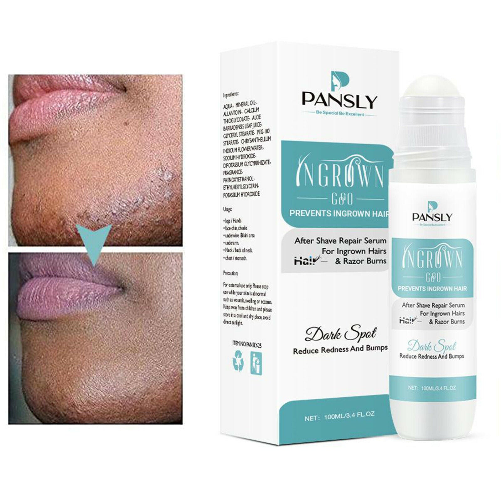 Aftershave Serum for Razor Bumps & Ingrown Hairs for Bikini Lines & Acne 100ml