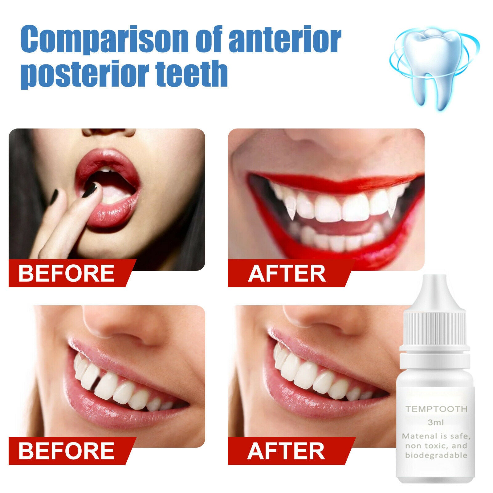 Dental 3ml Moldable Thermal Beads Denture Temporary Teeth Repair Kit Beads
