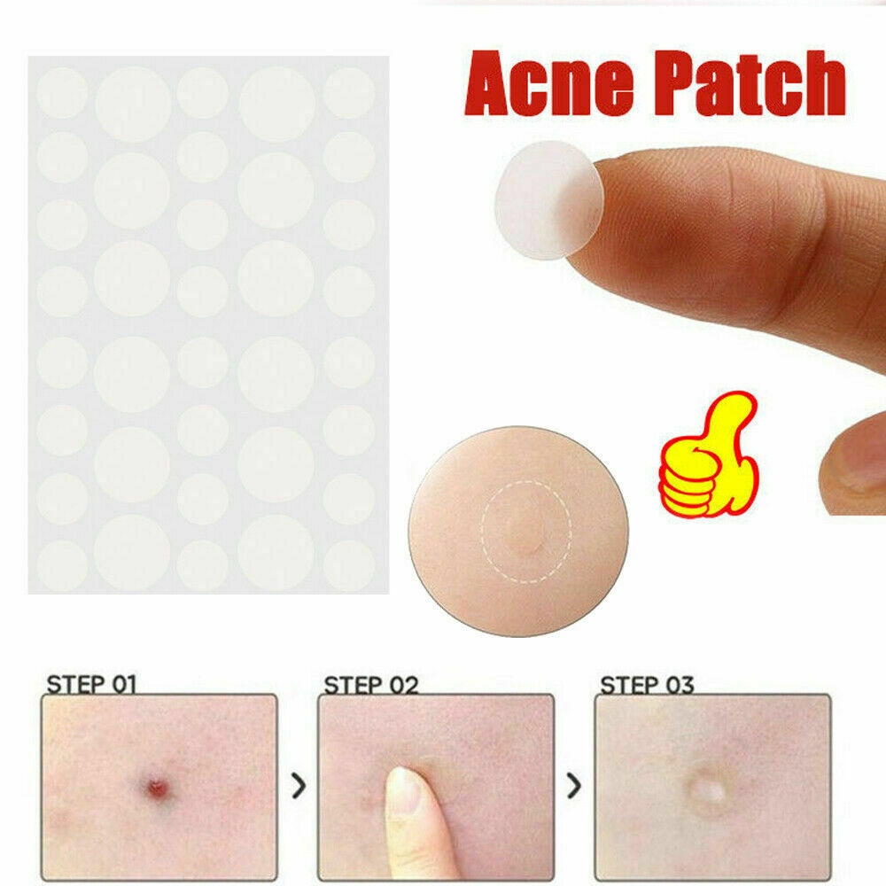 36X Skin Tag & Acne Patch Hydrocolloid Acne & Skin Tag Invisible Remover Patches