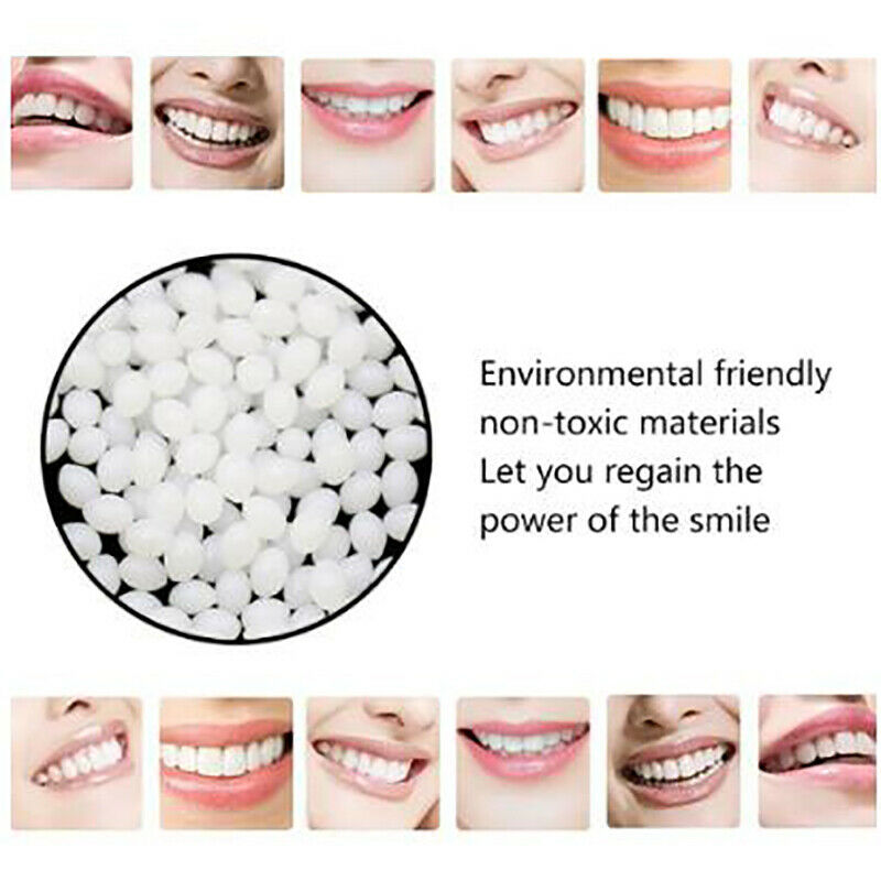 1Denture Solid Glue Dental Restoration Temporary Tooth Repair Kit Teeth A.l8