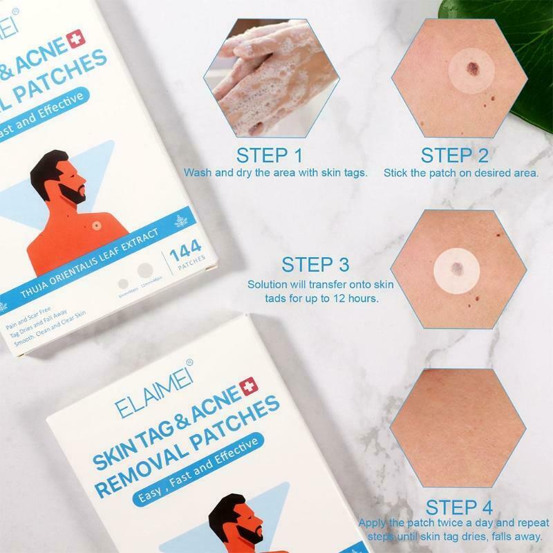 Skin Tag Remover Patches Repair Lotion Set Wart Remover Patches Fast Healing