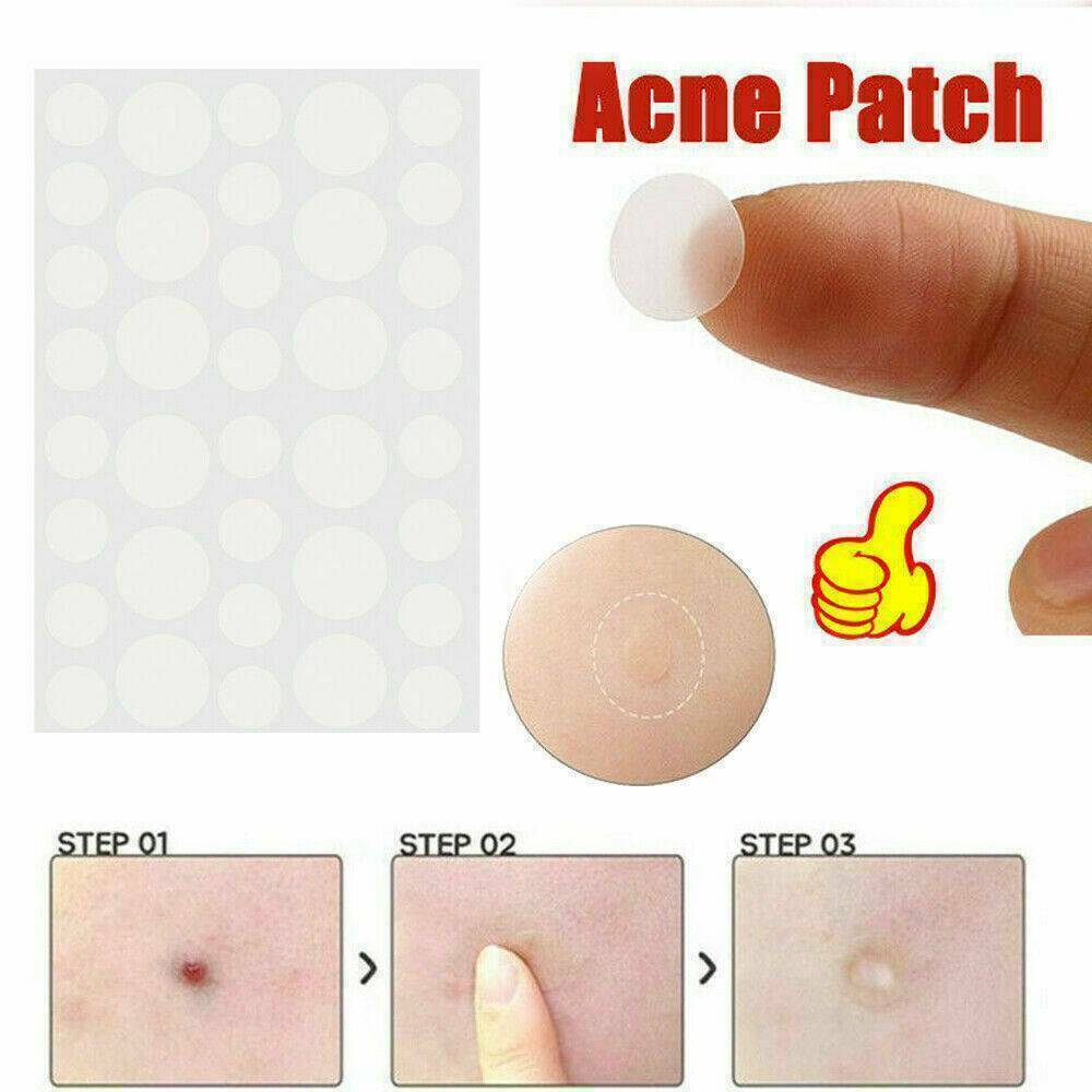 72PCS DERMOPATCHY ACNE SKIN TAGS PIMPLE REMOVER PATCH REMOVAL FACIAL CARE SPOT !