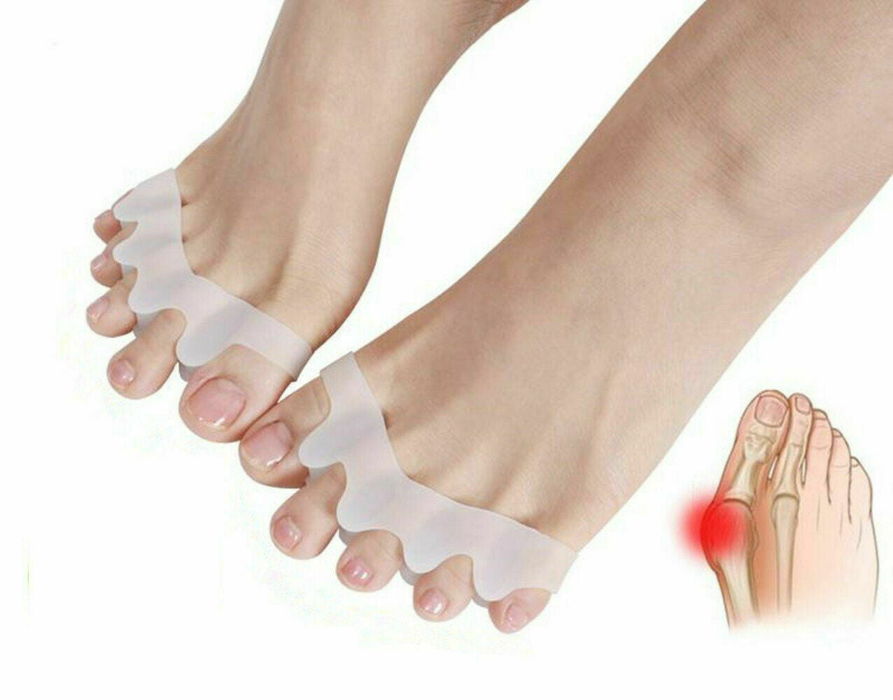 2x/Set Silicone Gel Bunion Toe Corrector Orthotics Straightener Separator Pain