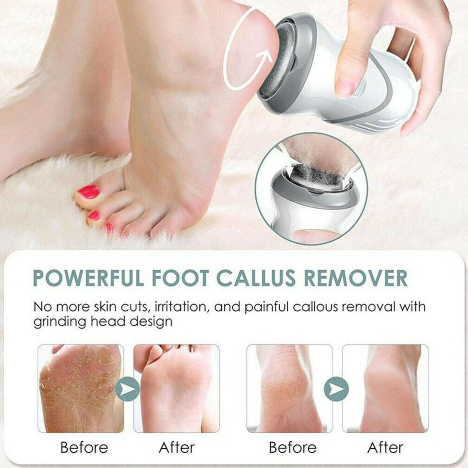 Electric Callus Remover Foot Care Device Pedicure Callus Rasp USB