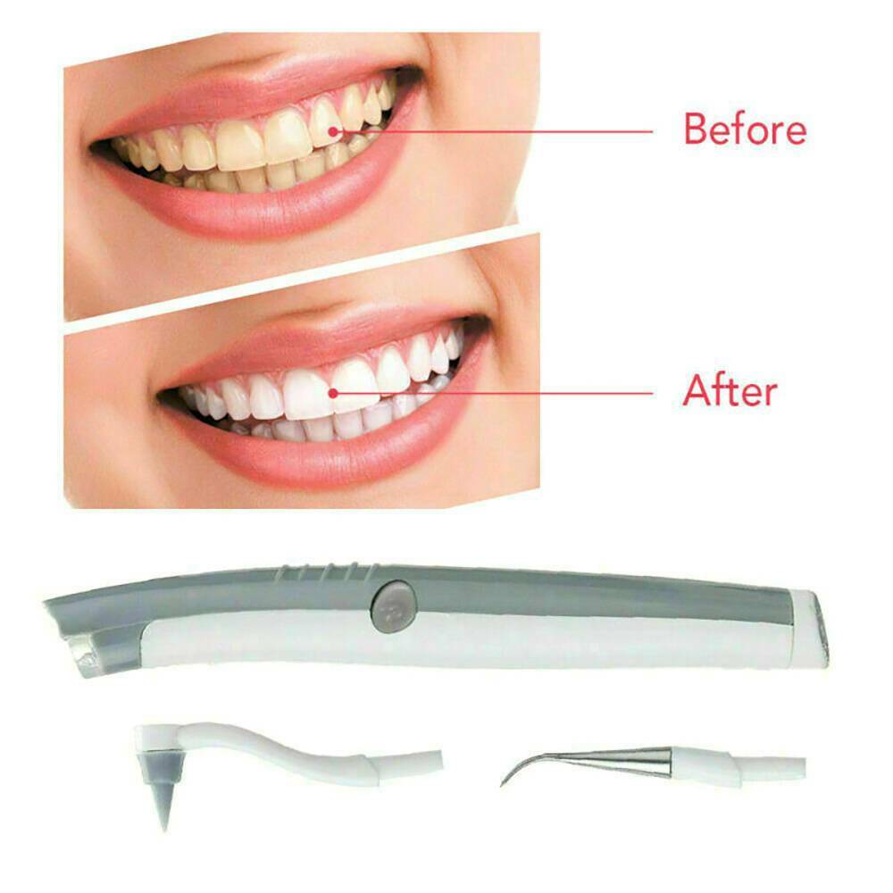 Portable Electric Ultrasonic Tooth Cleaner Dental Stain Plaque Tartar Remover!