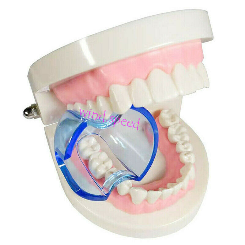 50pcs Dental Mouth Gag Opener Lip Retractor Cheek Expander for Posterior teeth
