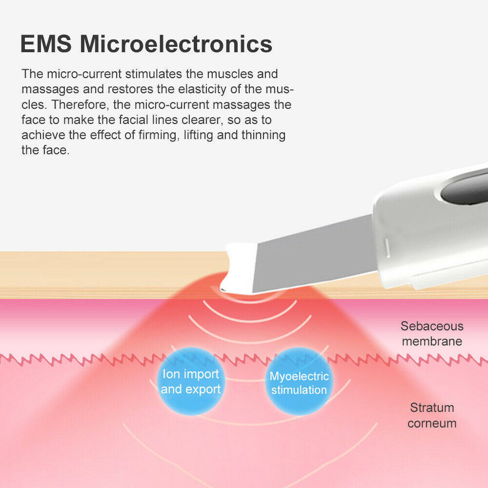 Ion Ultrasonic Skin Scrubber Blackhead Peeling Remover Facial Pore Deep Cleaning