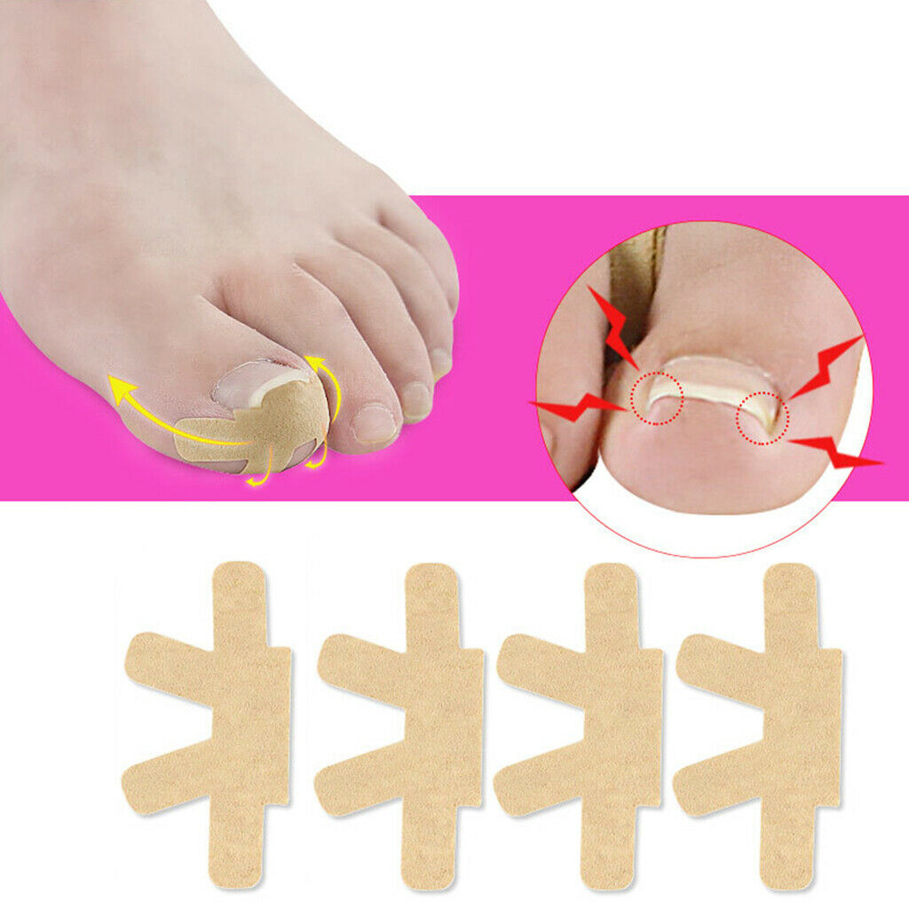 4pcs Elastic Ingrown Toenail Corrector Strips Treatment Toenail Patch Brace