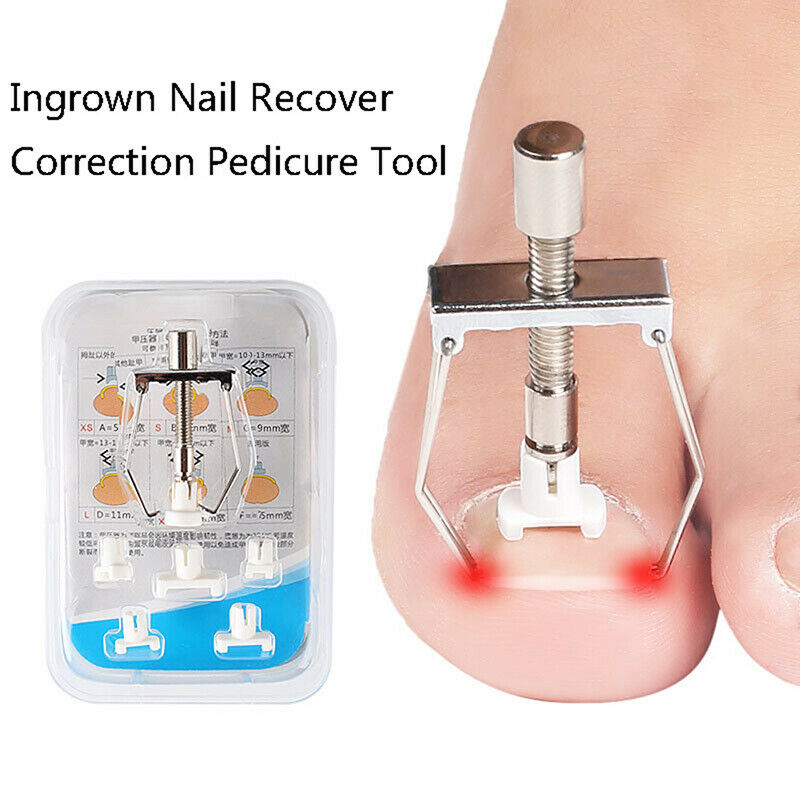 Ingrown Nail Recover Correction Pedicure Toenail Fixer Care Tool Nail CorrecFCA