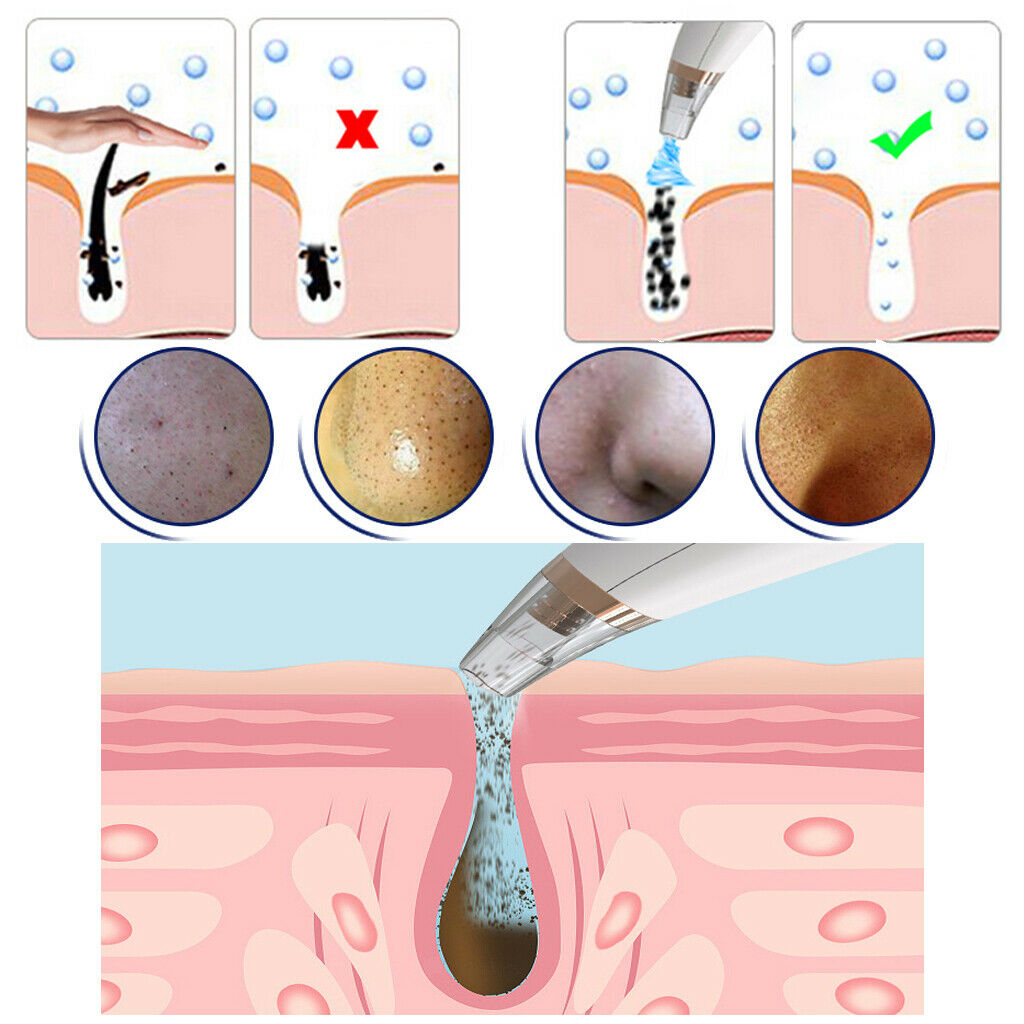 Electric LED Display Blackhead Suction Remover Dirt Cleaner Firming Device
