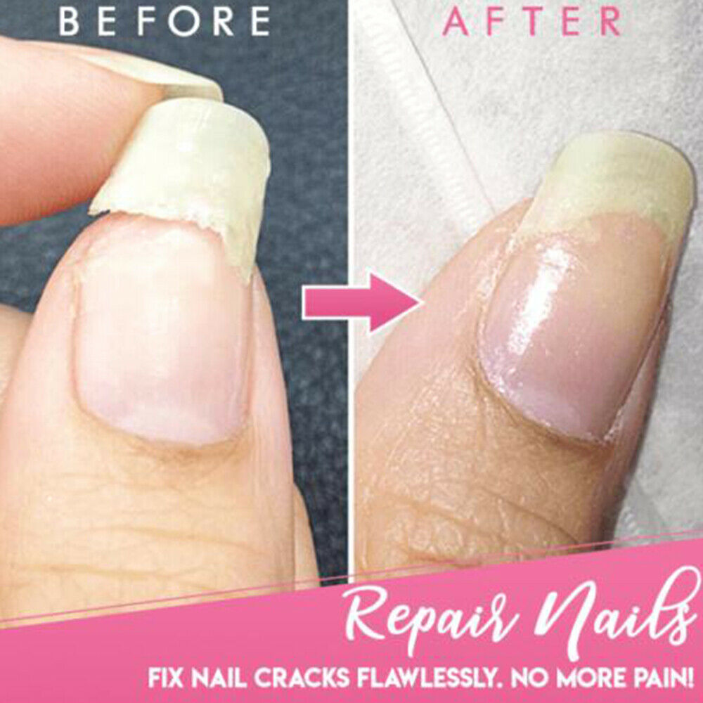 Cracked Nail Repair Gel Armor Nails Gel Coat Growth Treatment Strong Repair USA.