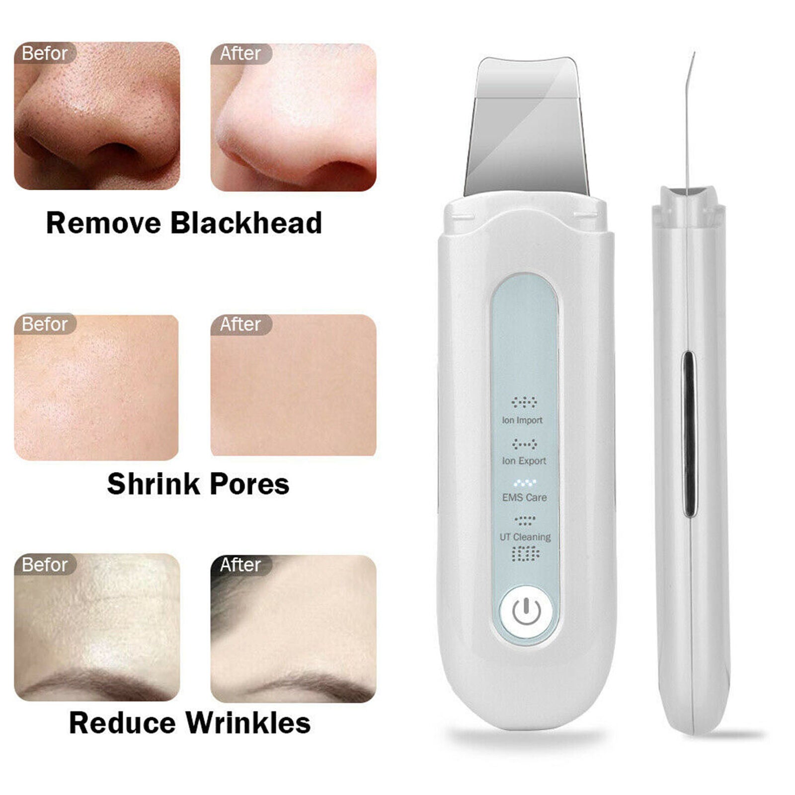 Facial Ultrasonic Skin Scrubber Spatula Face Extractor Peeling Deep Cleaner Tool