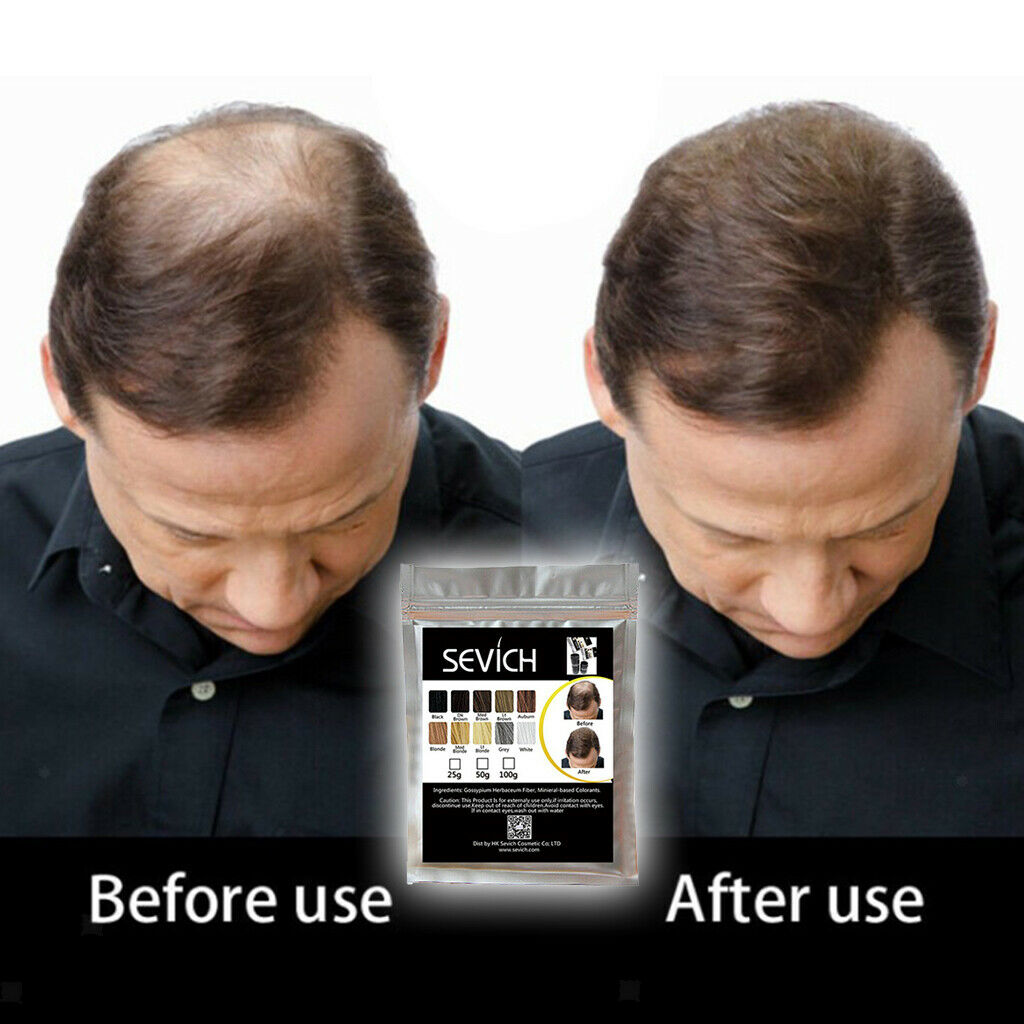 Instant Hair Building Thickening Fiber Powder for Hair Loss 100g Dark Wood