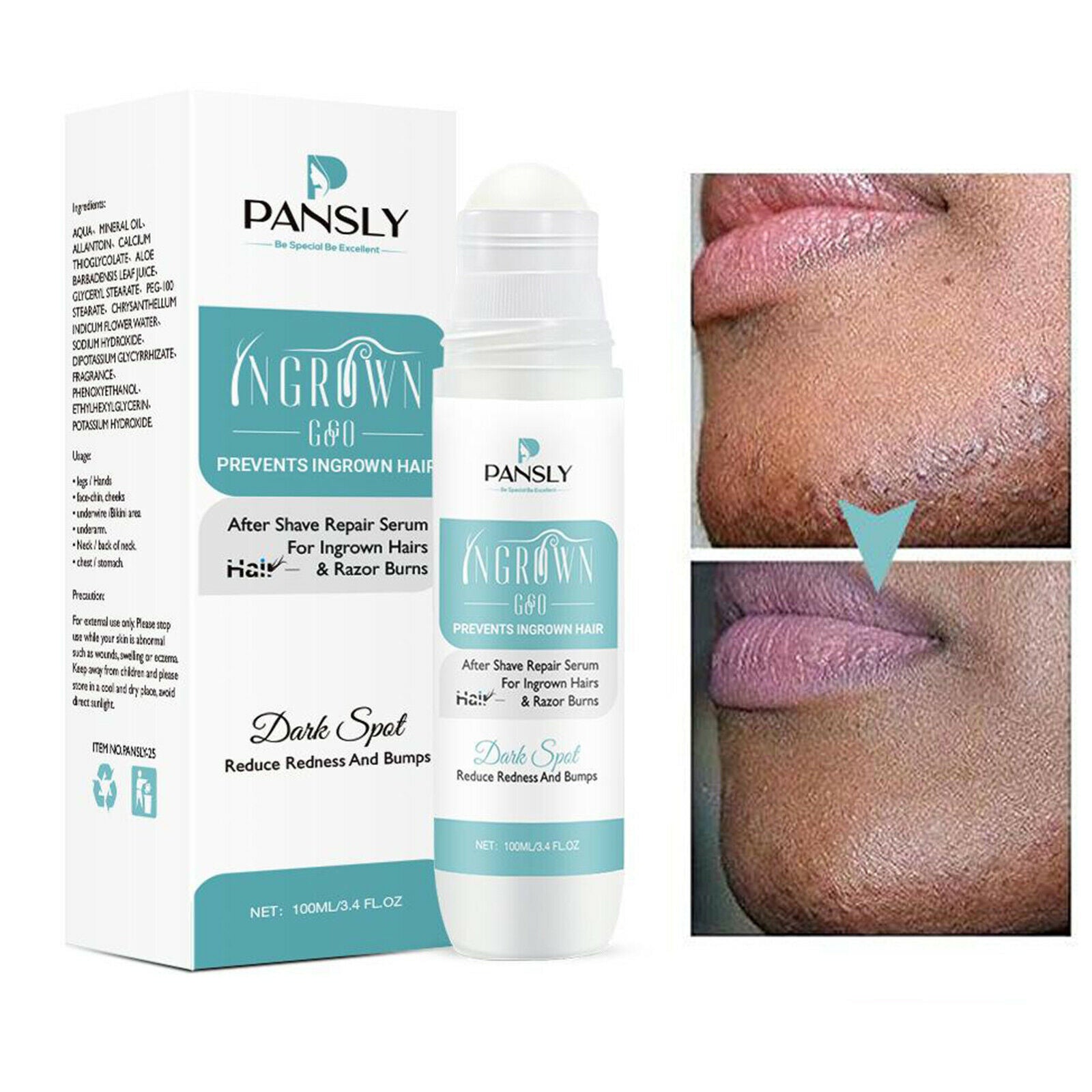 Aftershave Serum for Razor Bumps & Ingrown Hairs for Bikini Lines & Acne 100ml
