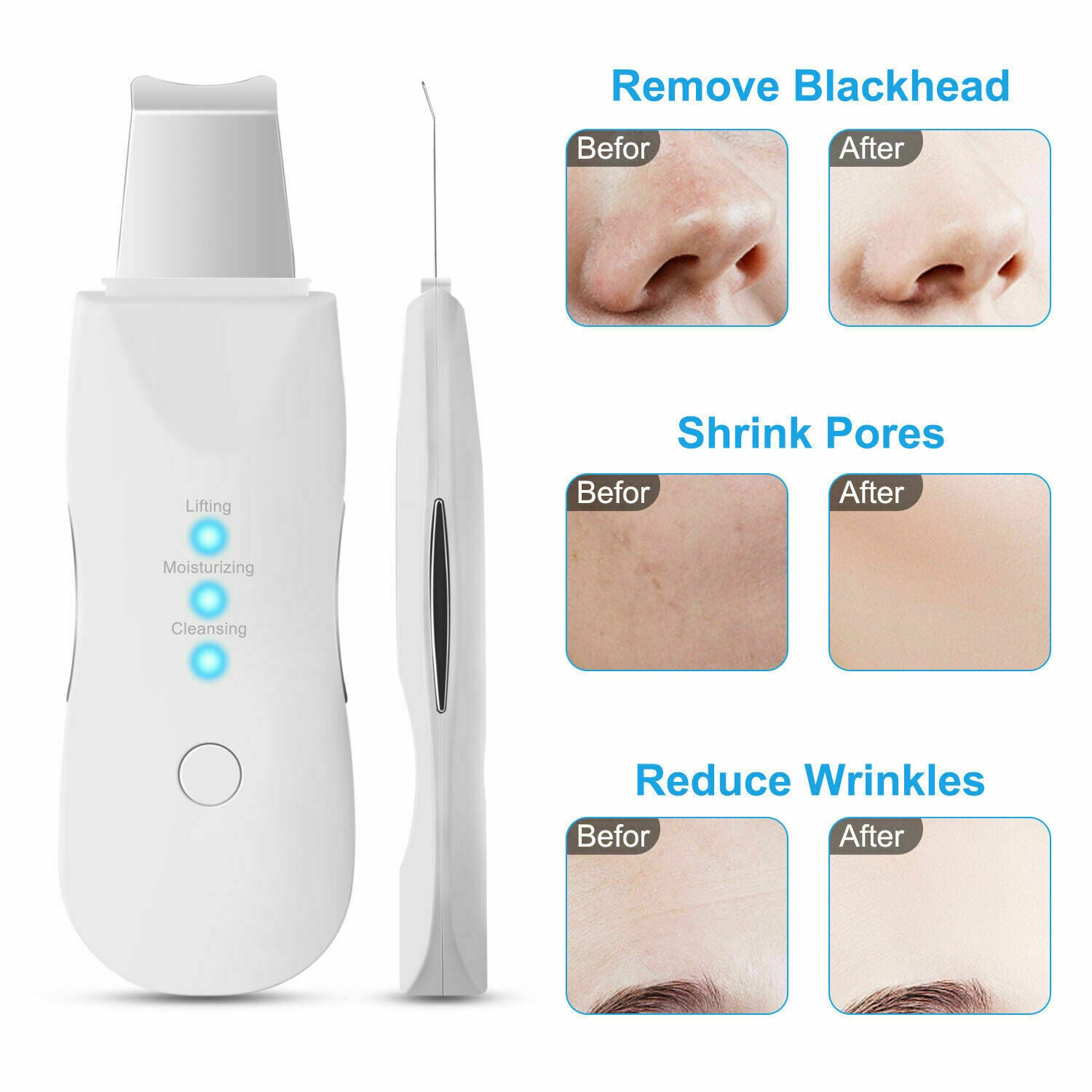 Ultrasonic Facial Skin Scrubber Spatula Face Extractor Peeling Deep Cleaner Tool