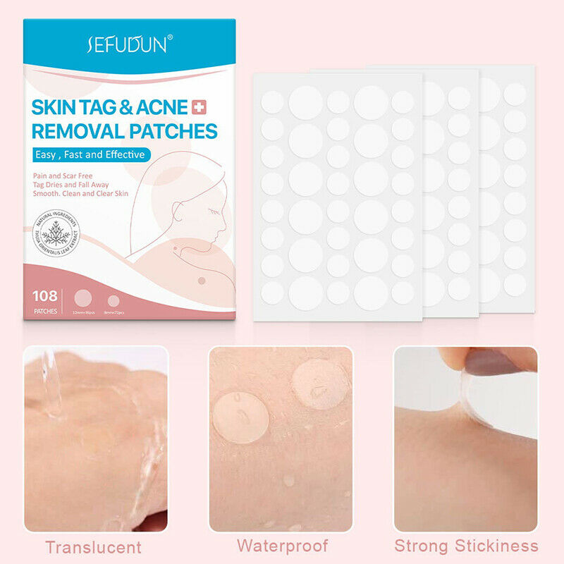 108pcs Skin Tag Remover Patch Hydrocolloid Acne Pimples Moles Zits WartsB CH SJ
