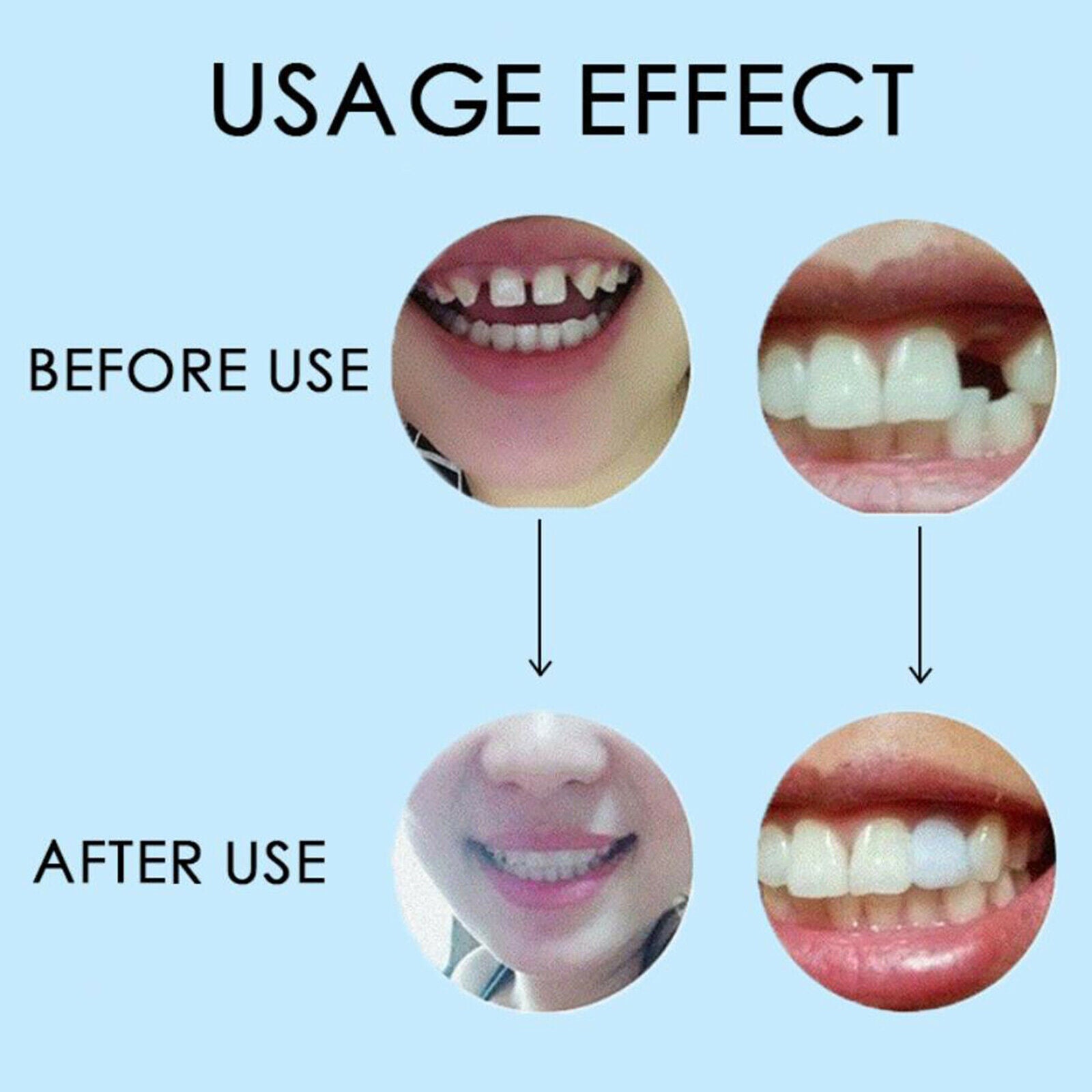 Dental 50g Thermal Beads Teeth Veneers Denture Temporary Tooth Repair Beads