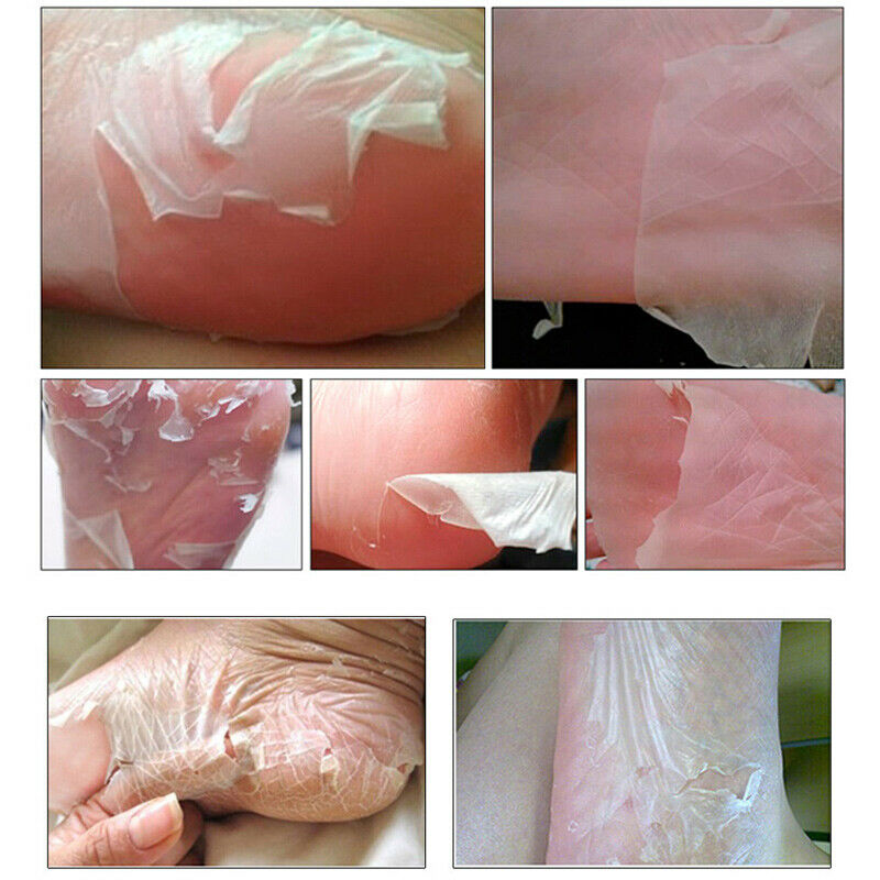 3 Pair Exfoliating Scrub Foot Care Peeling Sock Baby Soft Feet Removes Dead Skin