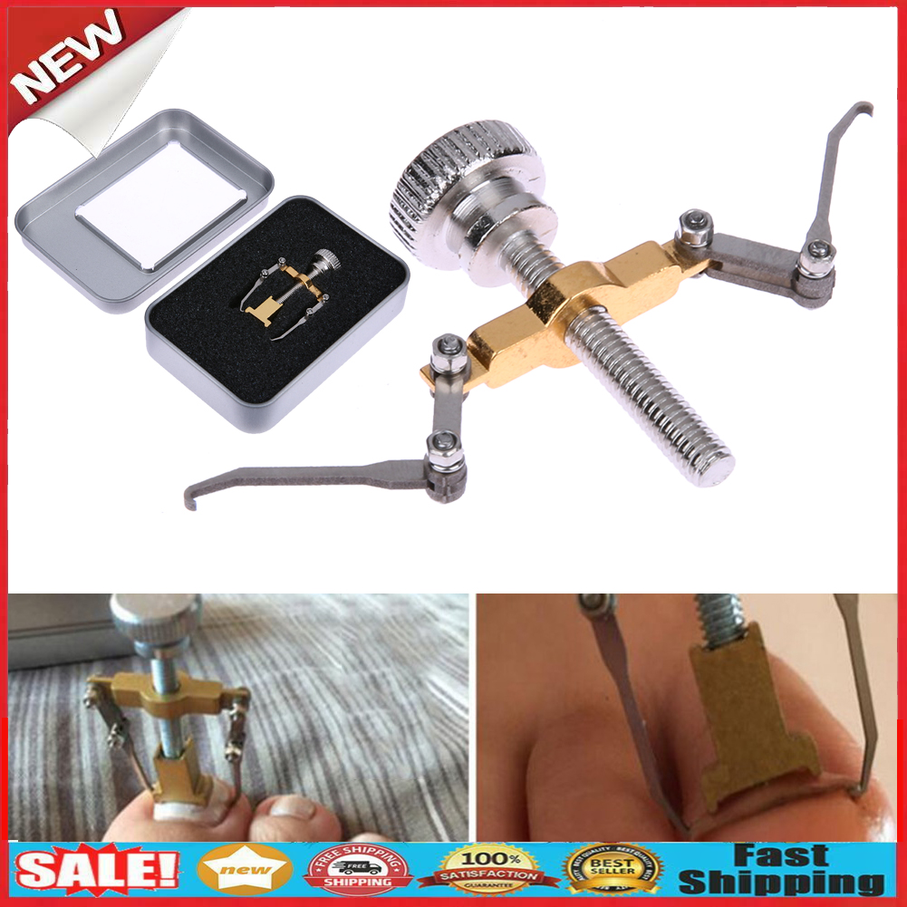 Ingrown Toenail Corrector Foot Toe Nail Care Orthotic Acronyx Onyxis @