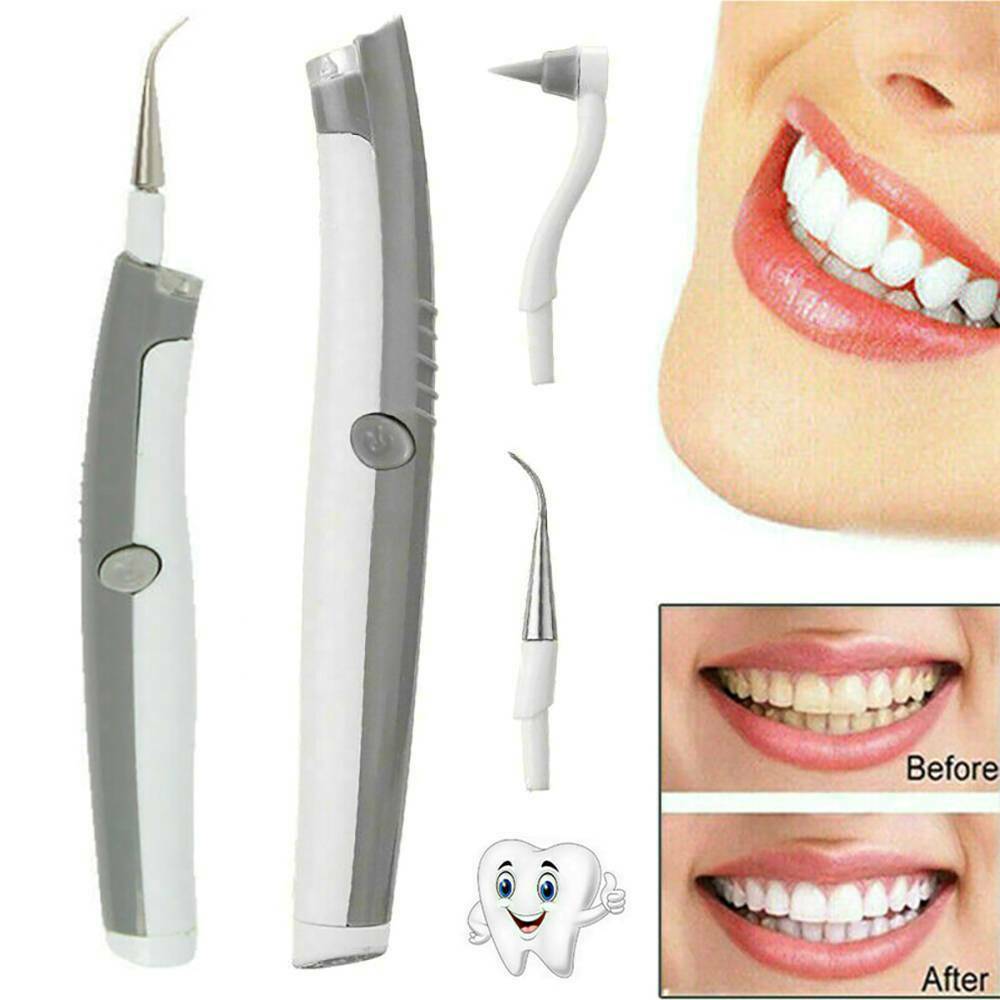 Portable Electric Ultrasonic Tooth Cleaner Dental Stain Plaque Tartar Remover!